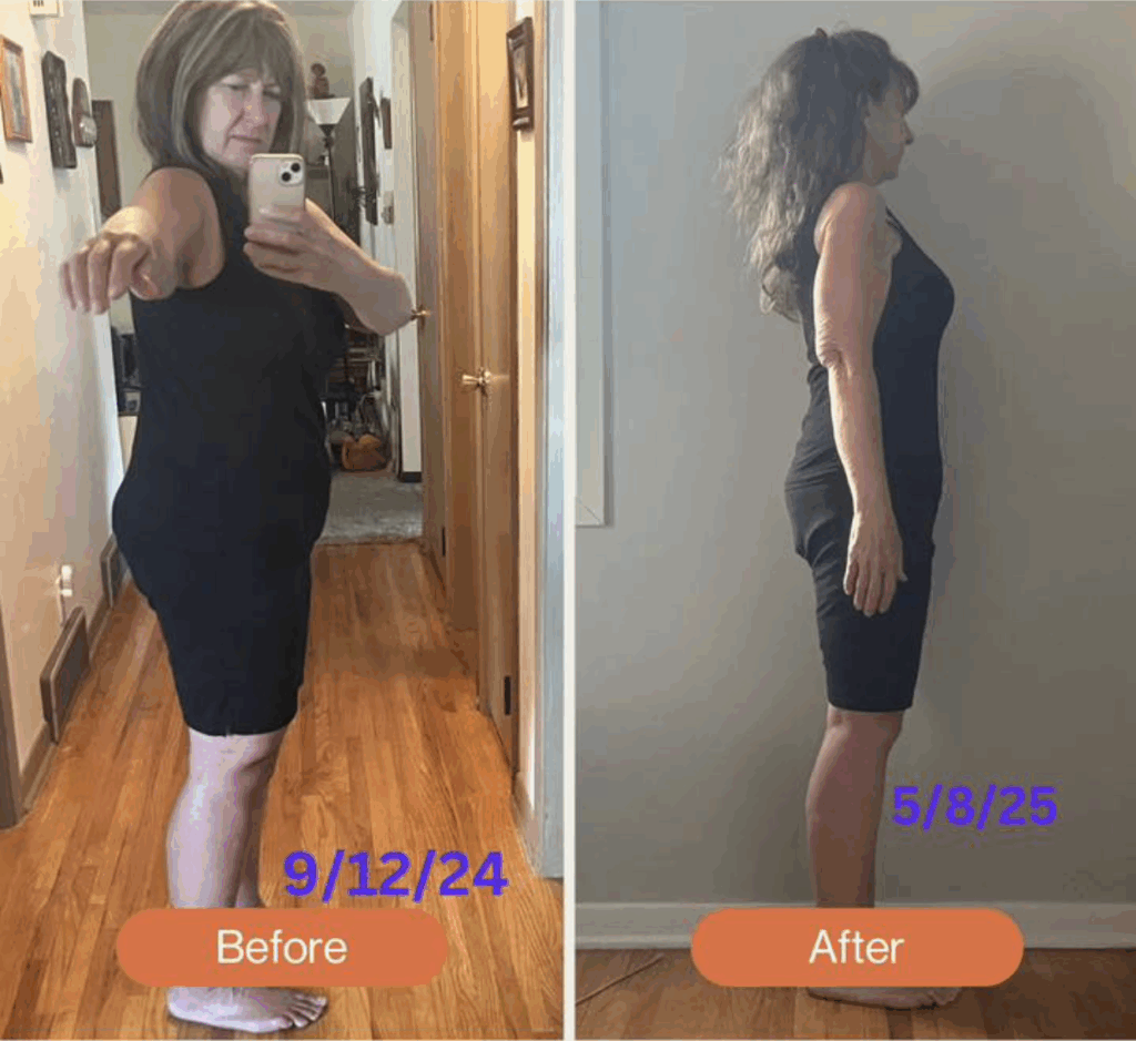 Sandra Mosteller's before and after photos show that she lost weight with the Skinny Drops