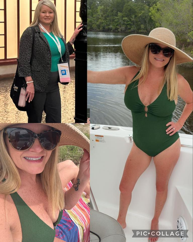 Tina Bundy's before and after photos show noticeable weight loss with the Skinny Drops