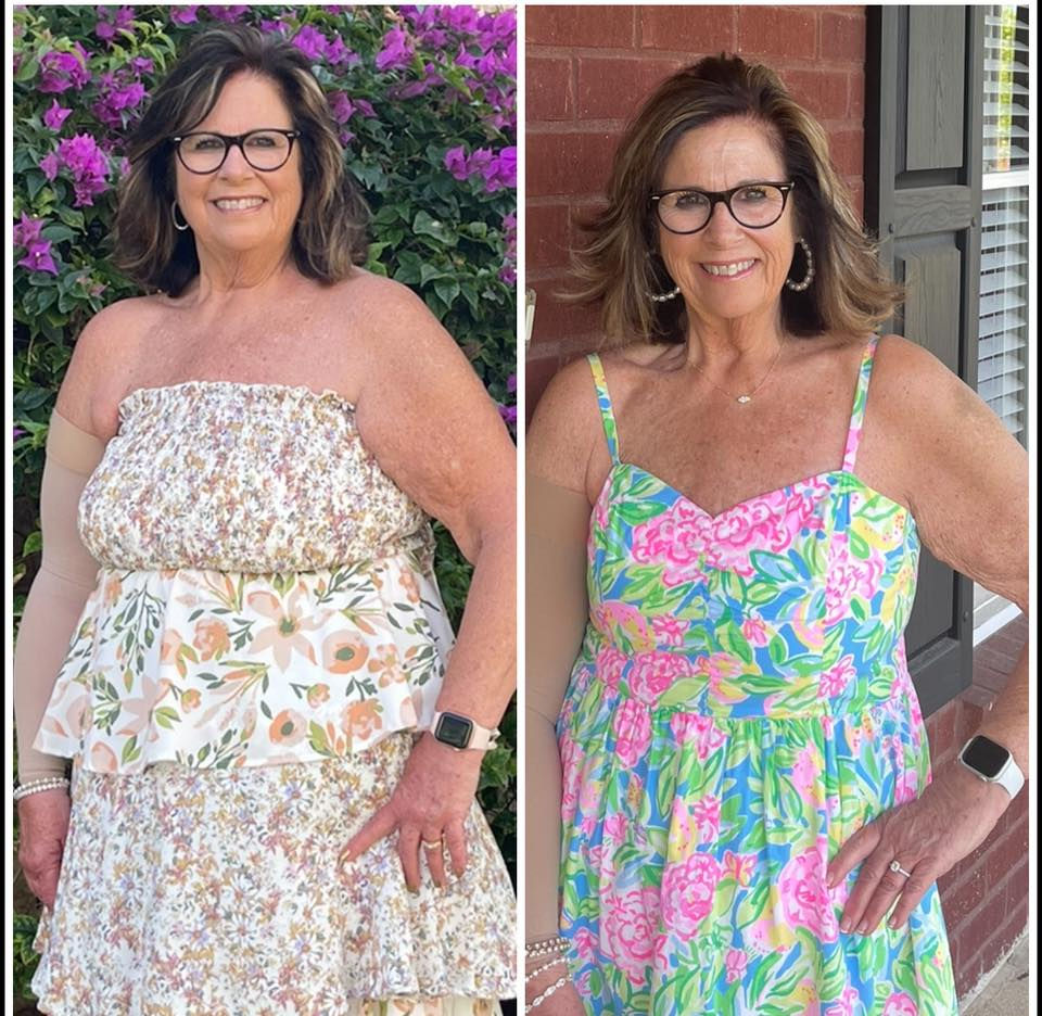 Teresa Sanderson O'Neal's before and after photos show 30 pounds of weight loss with the Skinny Drops
