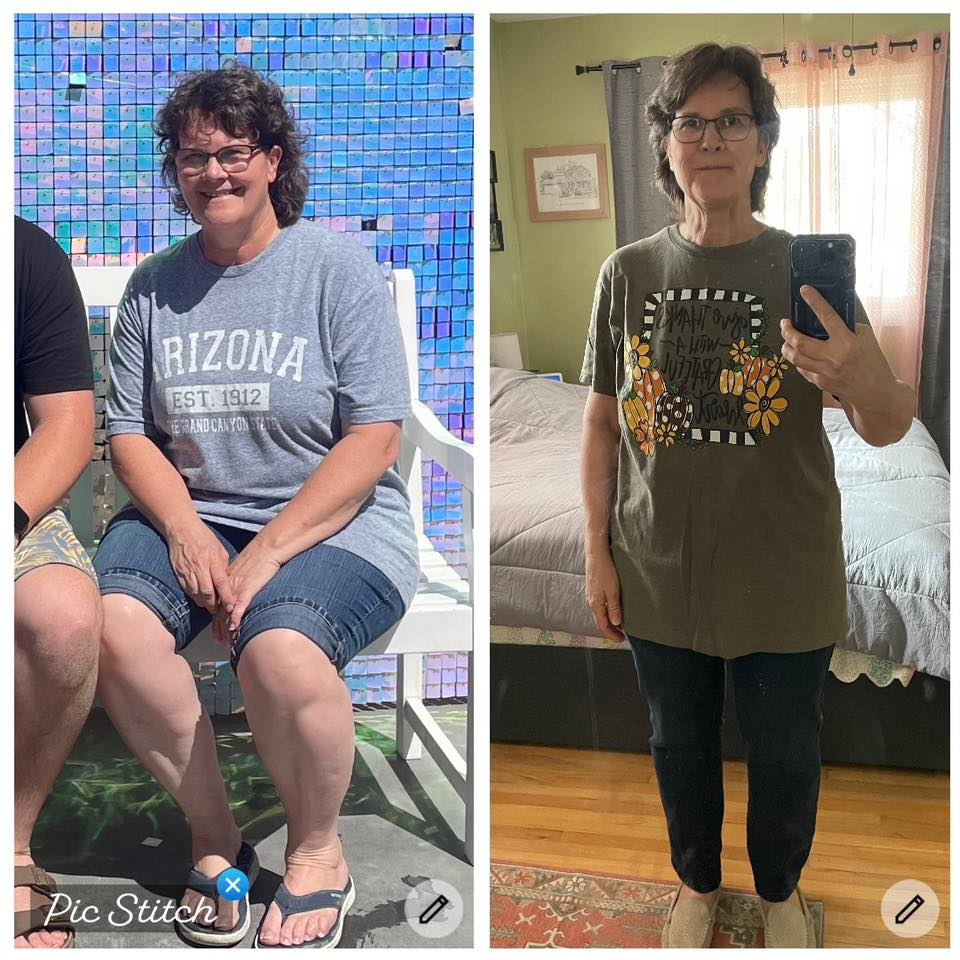 Peggy Gaube Confer's before and after photos show noticeable weight loss with the Skinny Drops