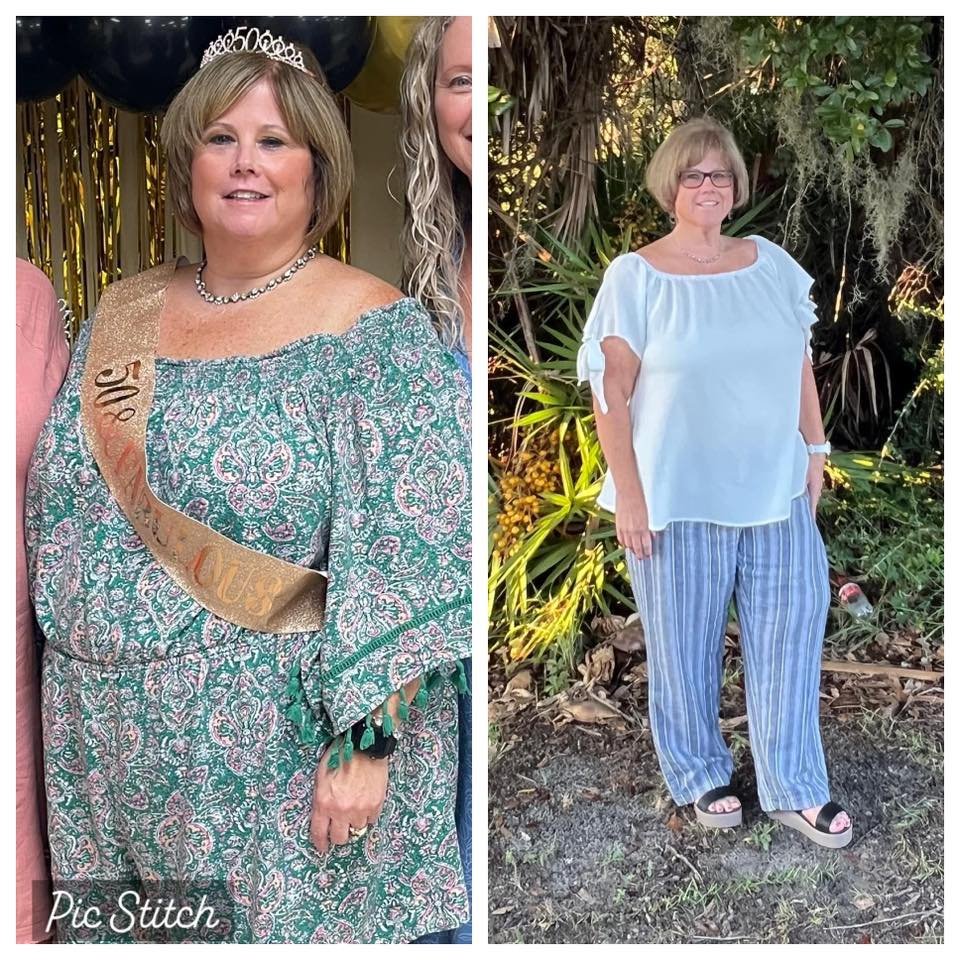 Lori Hiers' before and after photos show she is down 65 pounds with the Skinny Drops