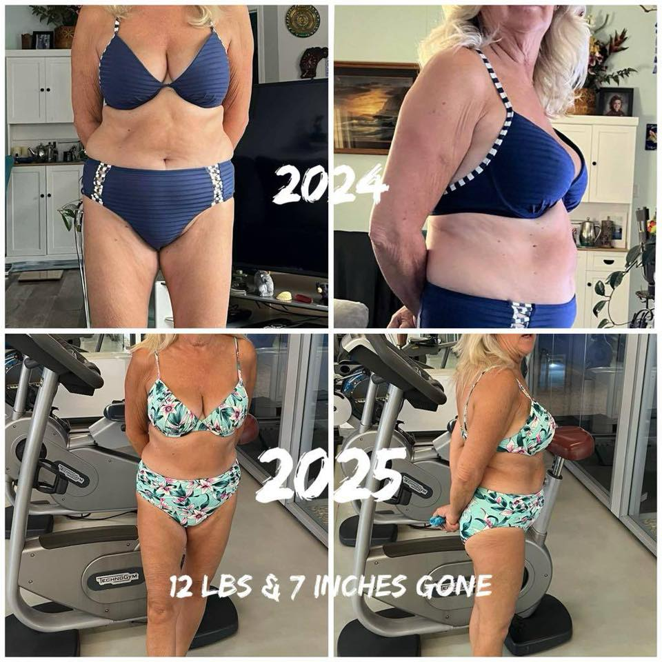 Sherry Sadleir's before and after photos show noticeable weight loss with the Skinny Drops