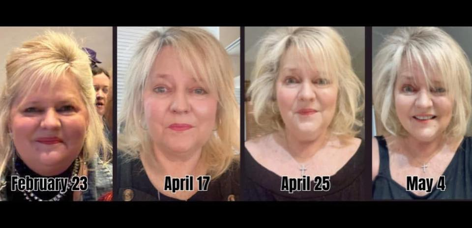 Roxanne Willis Tigue's before and after photos show noticeable reduction in inflammation on her face, thanks to the Skinny Drops