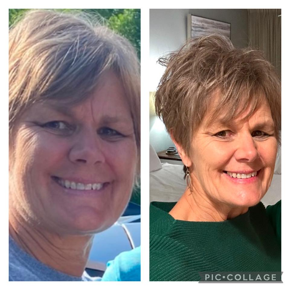 Mary Otterstatter's before and after photos show she is 30 pounds down with noticeable reduction in inflammation on her face, thanks to the Skinny Drops