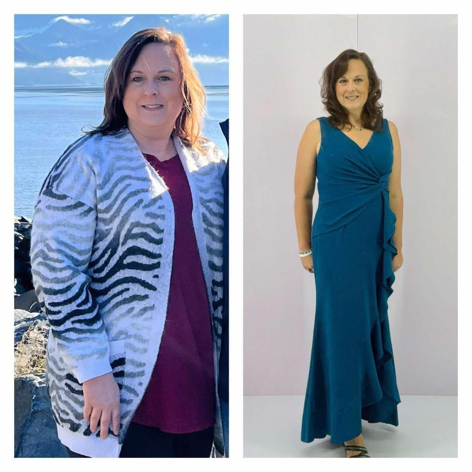 Amy Elliott's before and after photos show she is down 80 pounds, thanks to the Skinny Drops