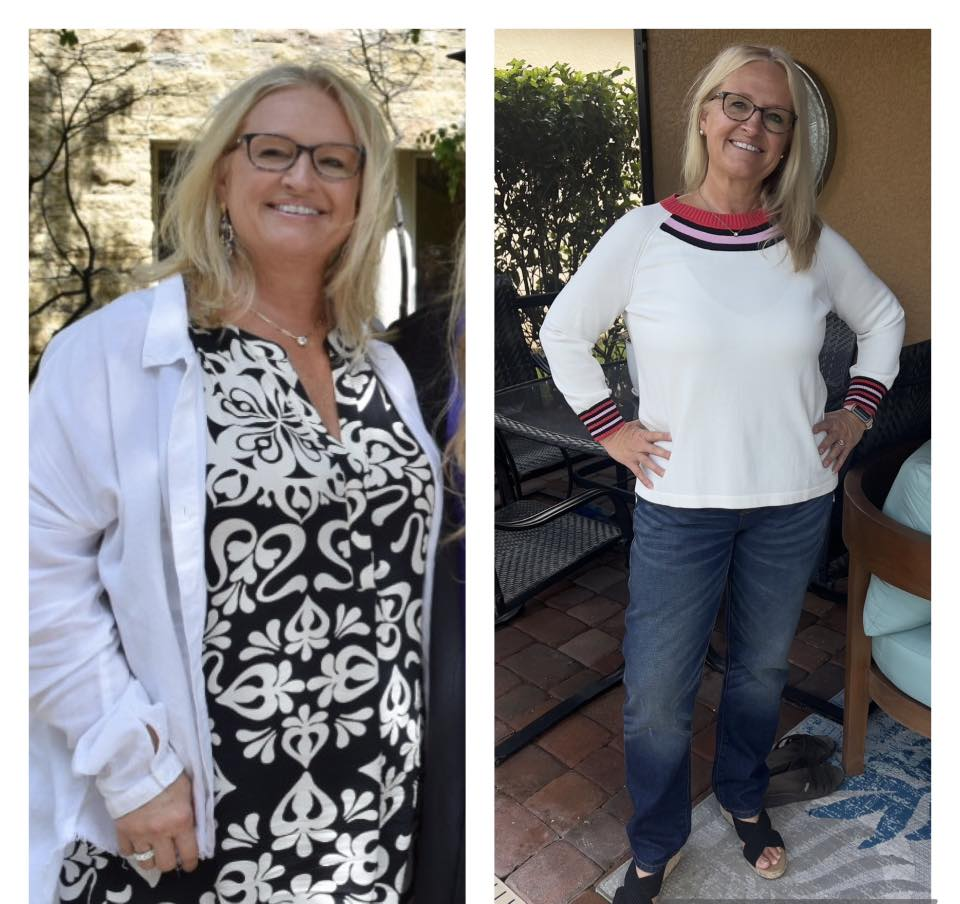 Paige Olson Lingman's before and after photos show reduced inflammation in her face, with 30 lbs released, thanks to the Skinny Drops