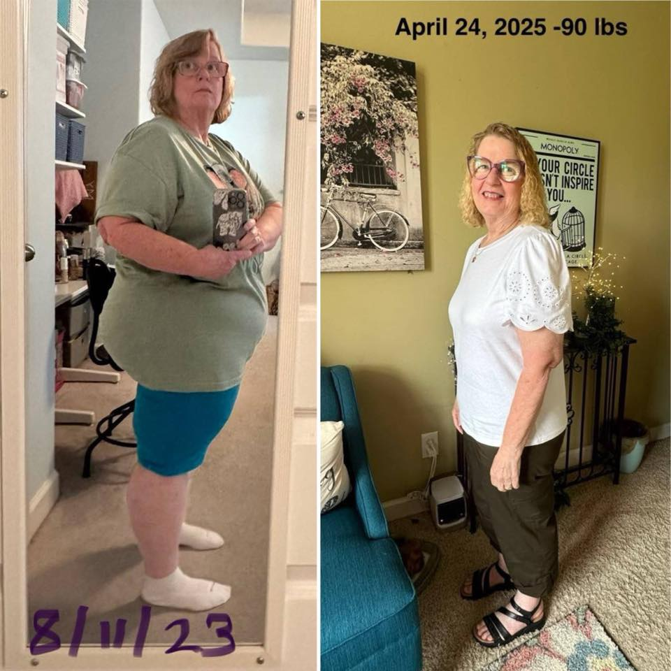 Patricia Ogden's before and after photos show noticeable weight loss of 90 lbs with the Skinny Drops