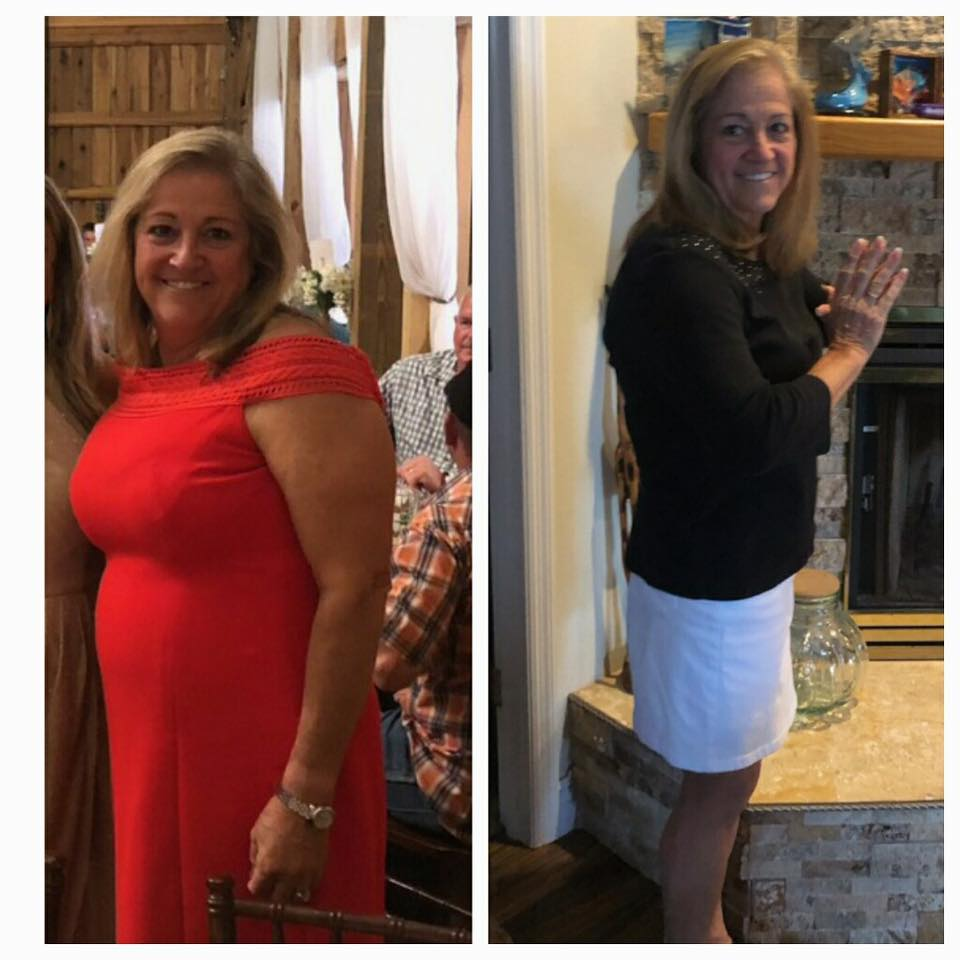 Gina M Ward's before and after photos show noticeable weight loss of 45 lbs in 100 days with the Skinny Drops