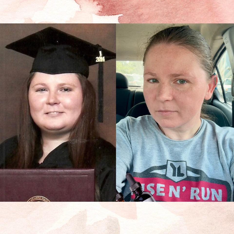 Courtney Guardino's before and after photos show reduced inflammation in her face, thanks to the Skinny Drops