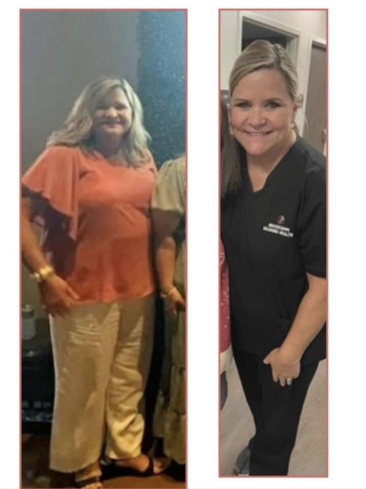 Lynn Hyde Tullos' before and after photos show reduced inflammation in her face, thanks to the Skinny Drops