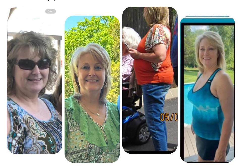 Regina Hastings' before and after photos show noticeable weight loss thanks to the Skinny Drops