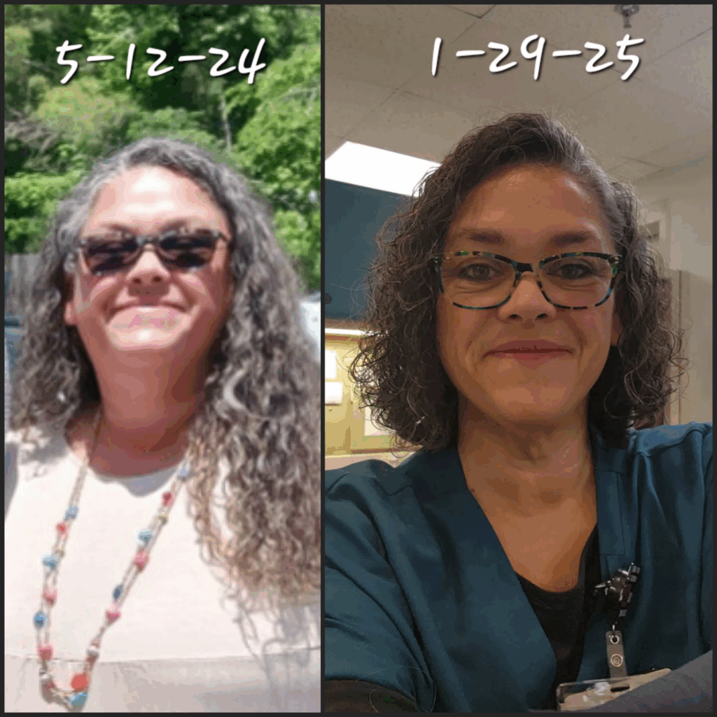 Deanne Goins' before and after photos show reduced inflammation in her face, with 104 lbs released in 8 months thanks to the Skinny Drops