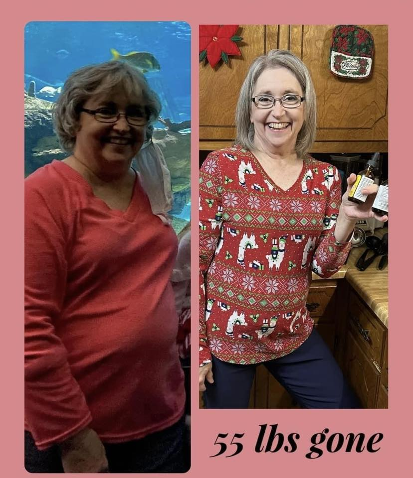 Benita Richey Austin's before and after photos show reduced inflammation in her face, with 104 lbs released in 8 months thanks to the Skinny Drops