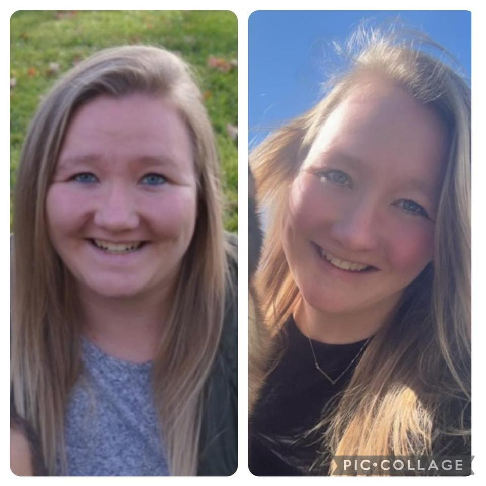 Deanne Goins' before and after photos show reduced inflammation in her face, with 50 lbs released thanks to the Skinny Drops