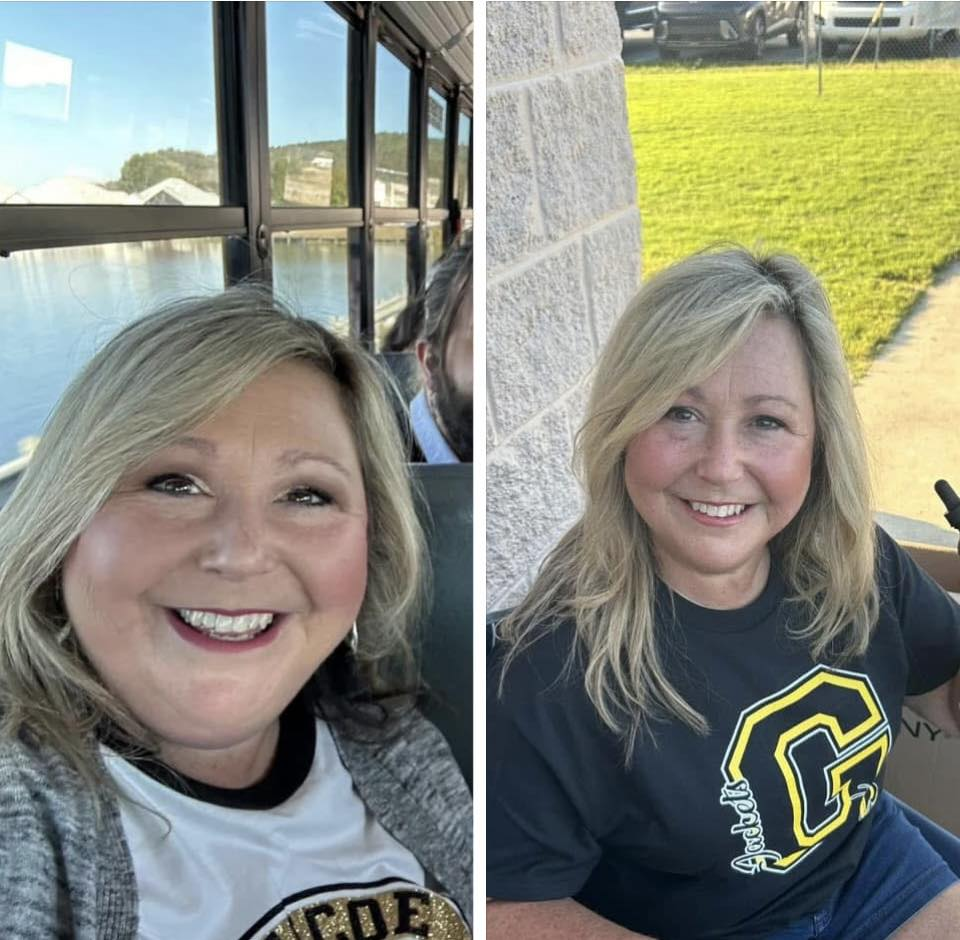 Misty Scales Carroll's before and after photos show reduced inflammation in her face, thanks to the Skinny Drops