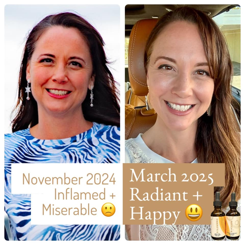 Kristin Vincelli' before and after photos show reduced inflammation in her face, thanks to the Skinny Drops