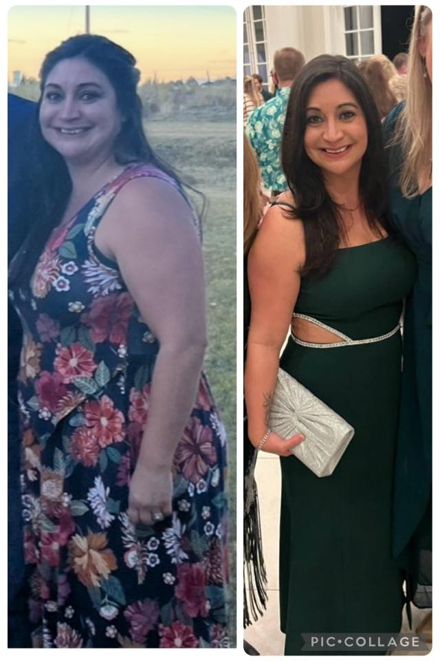 Marcia Echo's before and after photos show noticeable weight loss with the Skinny Drops