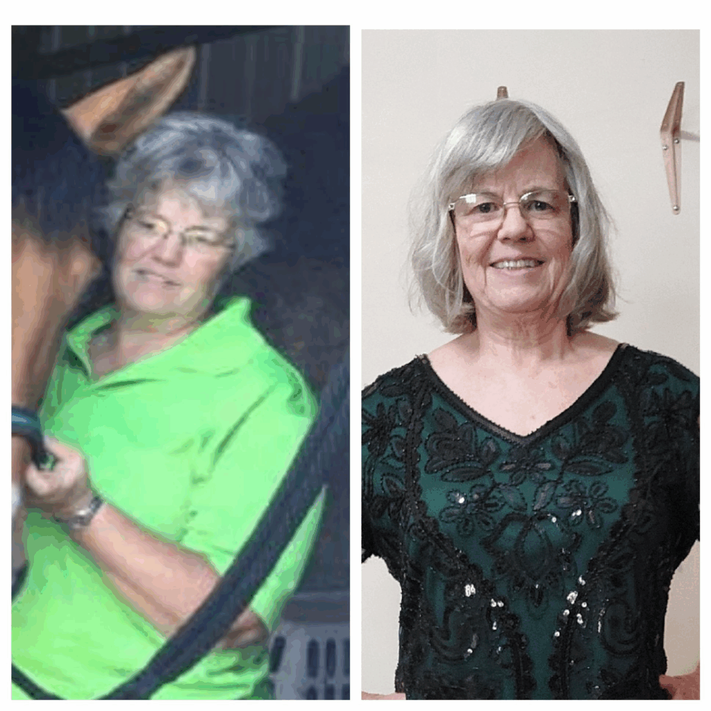 Carol Hibschman's before and after photos show she is down 45 lbs, reducing from size 18 to 10, thanks to the Skinny Drops
