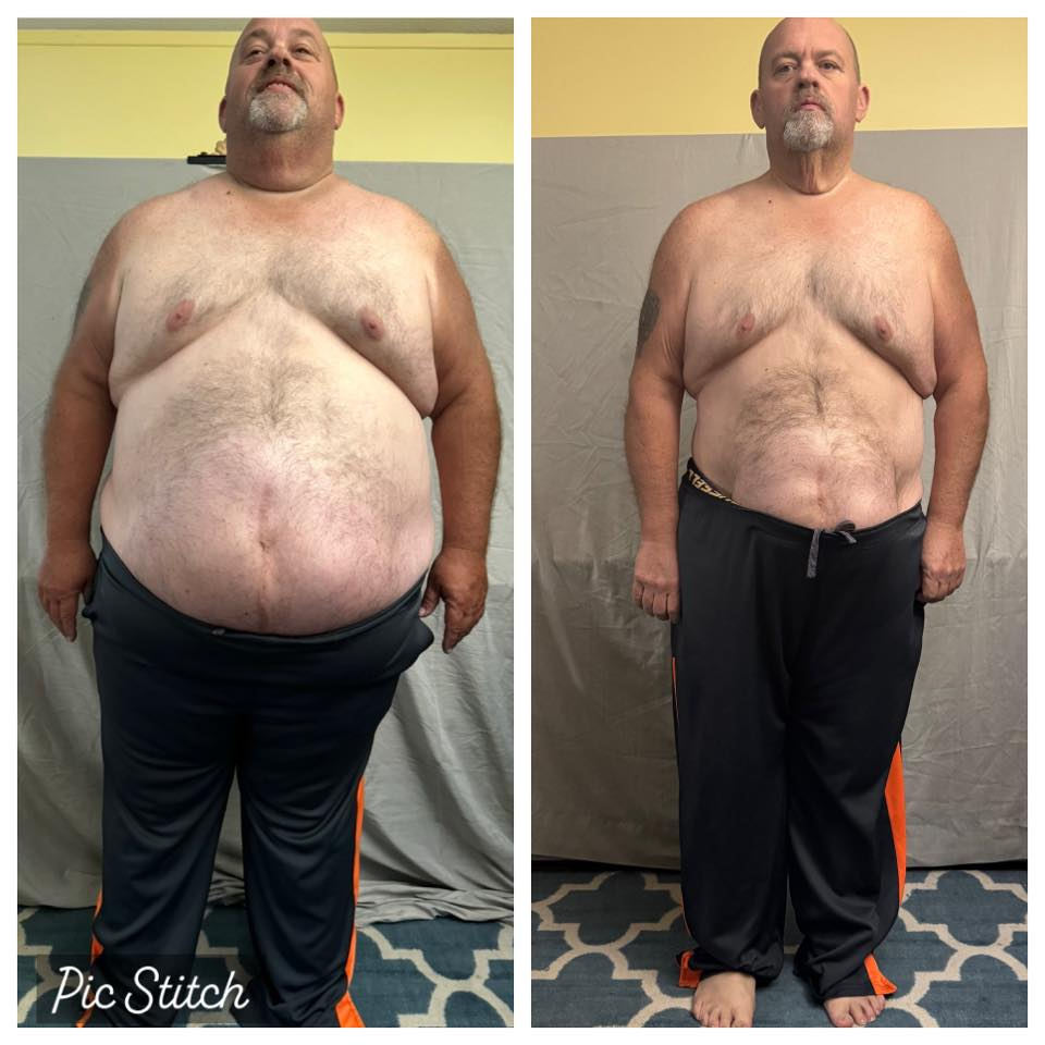Tim Mcpherson's before and after photos show over 100 lbs weight loss, from 423 to 280, thanks to the Skinny Drops